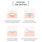 Some By Mi 30 Days Miracle Clear Spot Patch