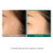 Some By Mi 30 Days Miracle Clear Spot Patch