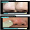 ilso - Super Melting Sebum Softener [150ml]