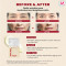 SEOUL 1988 Cream Retinal Liposome 1% + Fermented Rice , 50ml